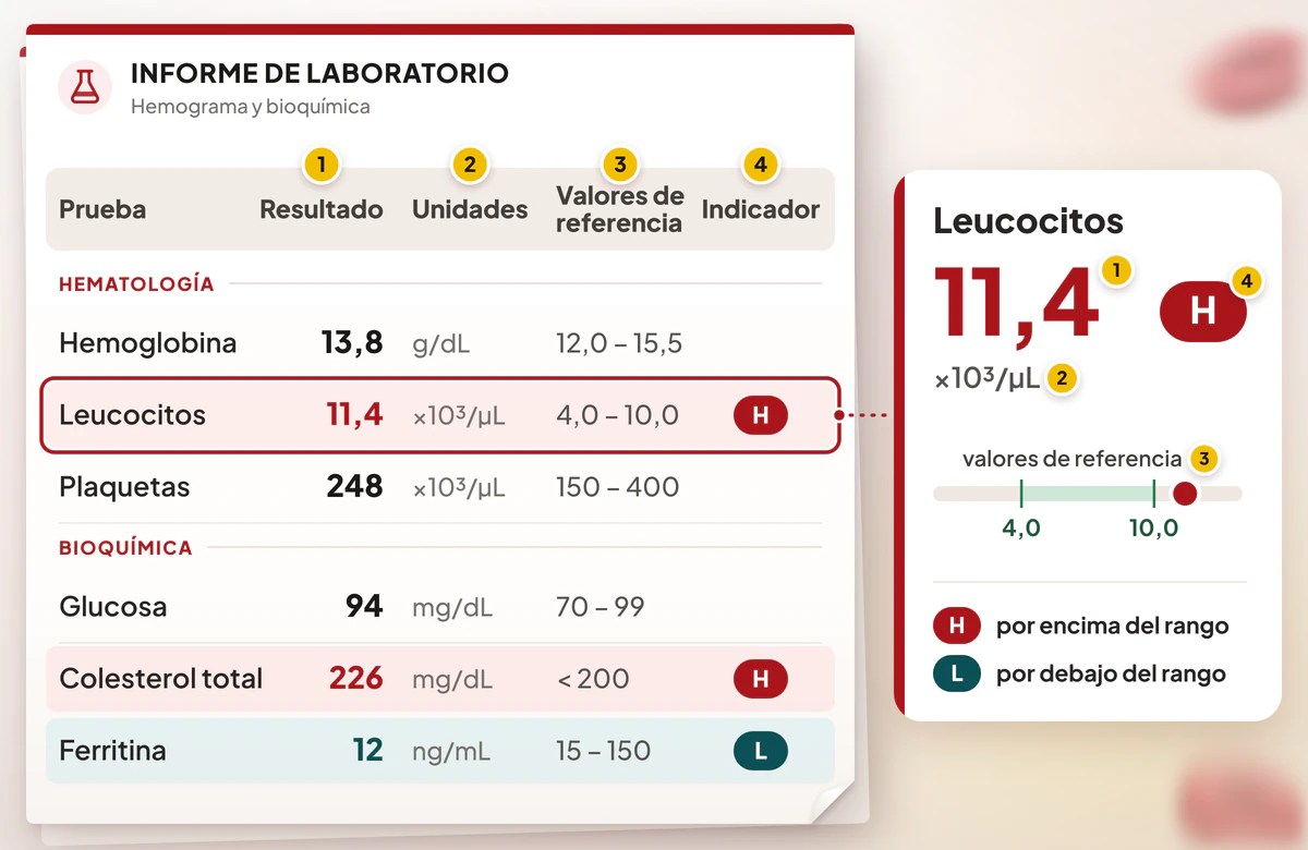 Informe de laboratorio con columnas numeradas de resultado, unidades y valores de referencia, y un valor alto ampliado